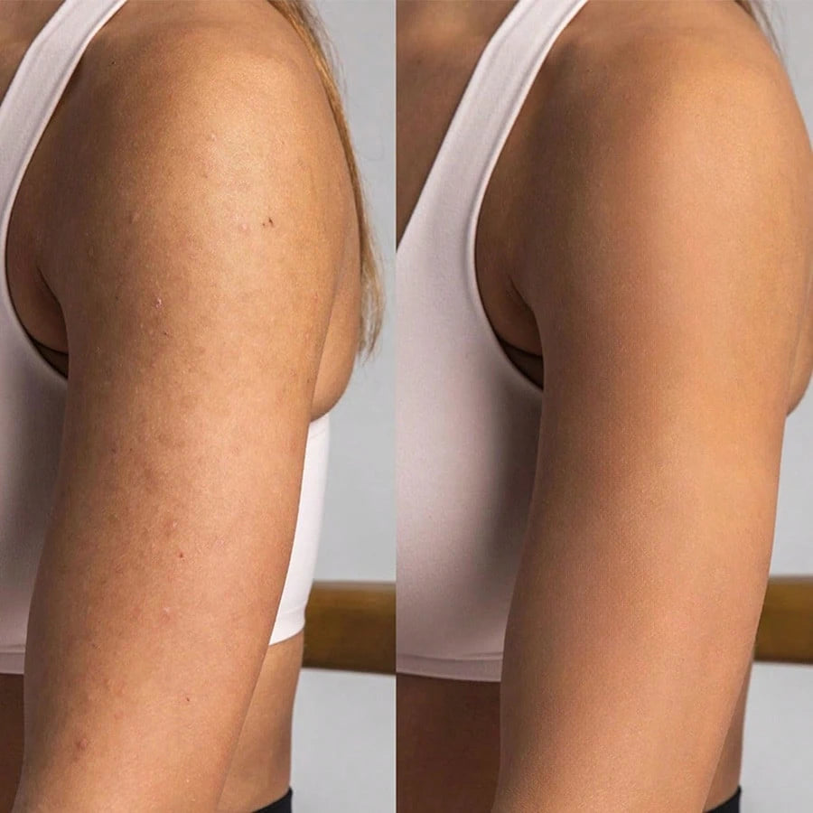 Advanced Body Concealer - Makeup Set, Waterproof Leg And Body Makeup - Tattoo Concealer