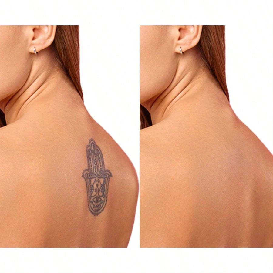 Advanced Body Concealer - Makeup Set, Waterproof Leg And Body Makeup - Tattoo Concealer